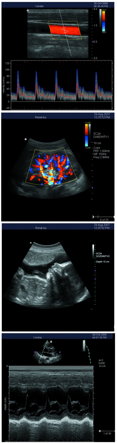 S5i ultrasound Scanner